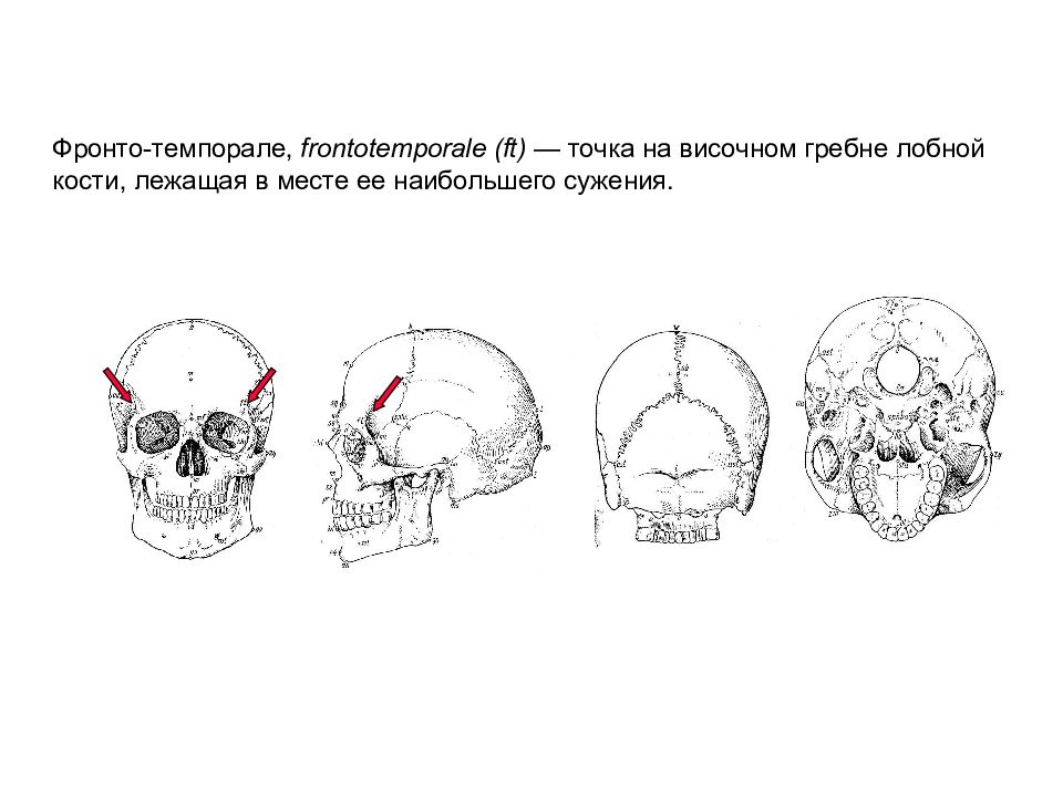 Лабиринт лобной кости. Височный гребень лобной кости. Фронто темпоральная точка. Антропологические точки черепа. Краниометрические точки на черепе.