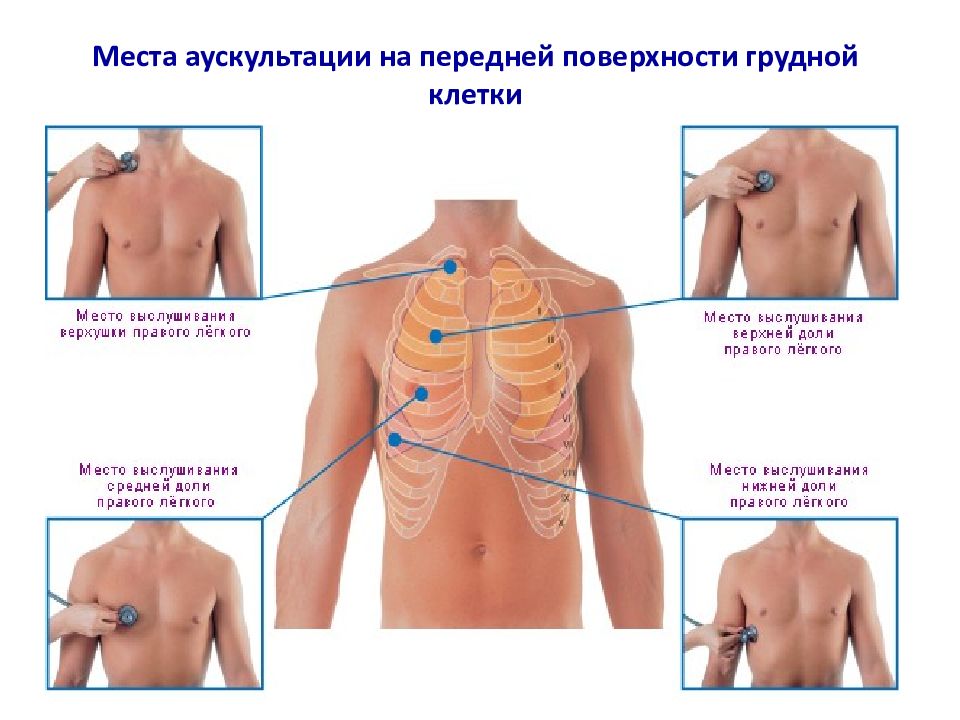 Бронхит аускультативная картина