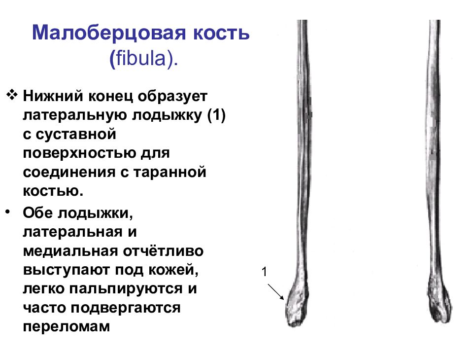 Левая малоберцовая кость. Кости голени малоберцовая кость. Строение малоберцовой кости анатомия. Малоберцовая кость строение. Малая берцовая кость анатомия.