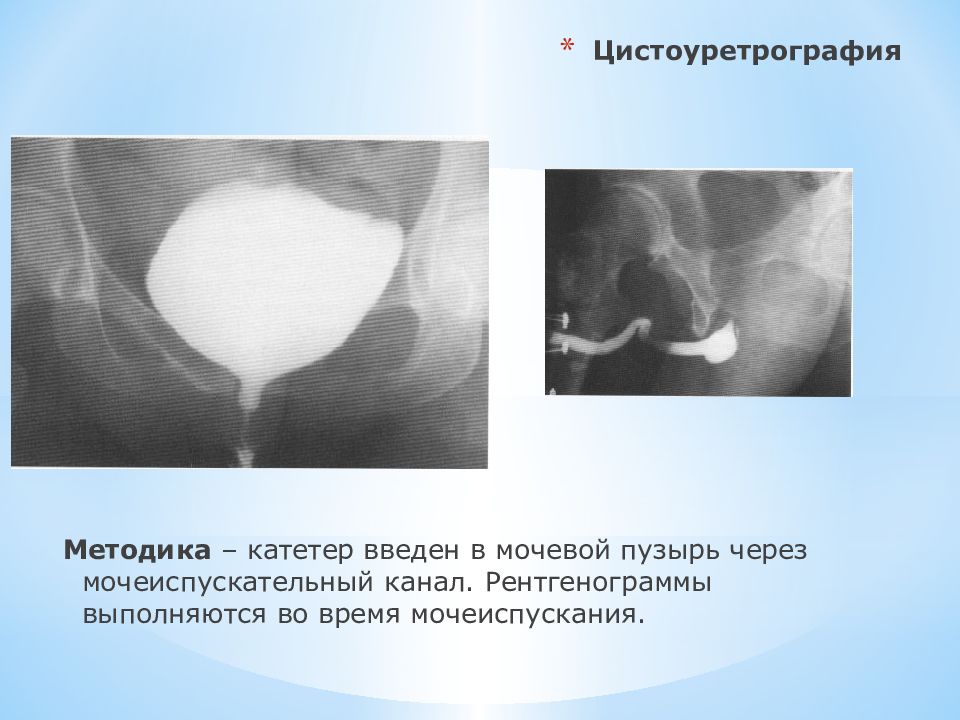 Лучевая диагностика почек презентация