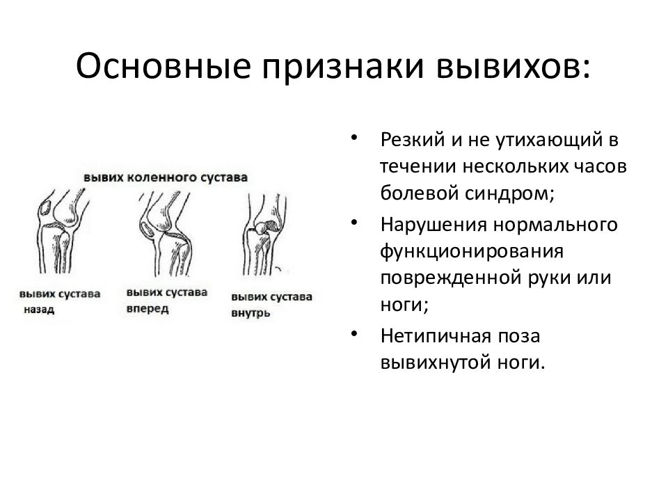 Растяжение запястья руки. Характерные признаки вывиха сустава. Вывих суставов кисти симптомы. Главный признак вывиха сустава. Вывихи суставов признаки и первая помощь.