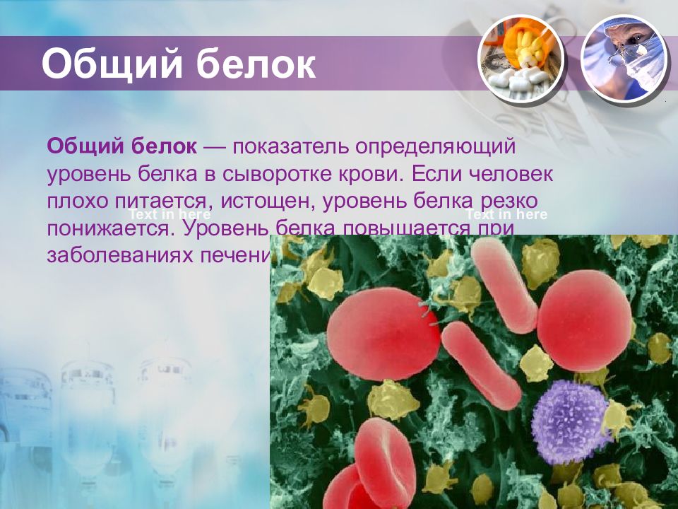 Причина повышенного белка. Белок в крови аббревиатура. Препараты для повышения белка в крови. Как понизить белок. Общий белок понижен симптомы.