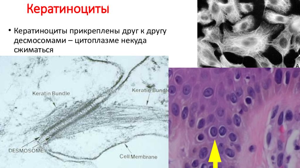 Кератиноциты. Кераноциты гистология. Кератиноциты эпидермиса. Кожа гистология кератиноциты. Кератиноциты базального слоя.