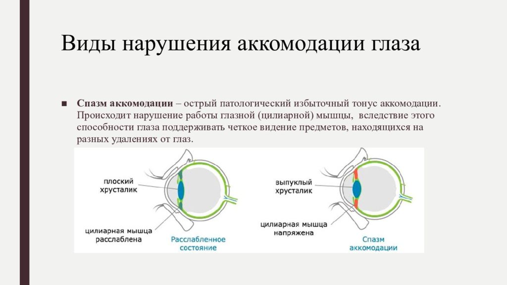 Нарушение аккомодации. Нарушение аккомодации глаза. Патология аккомодации. Процесс аккомодации глаза.