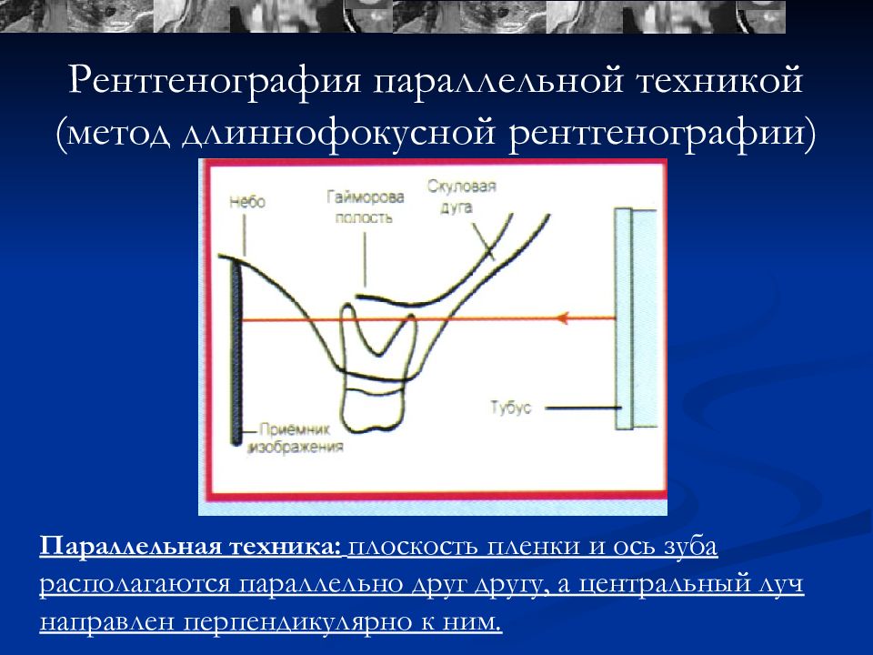 Рентгенодиагностика в стоматологии презентация