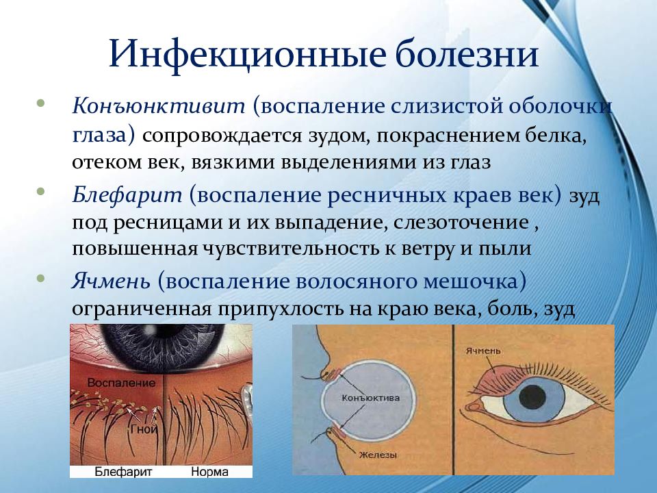 Заболевания и повреждения глаз презентация