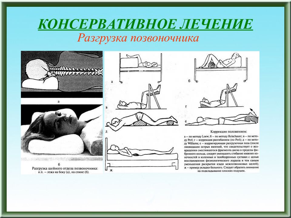 Как разгрузить спину. Как разгрузить позвоночник. Разгрузочные позы для позвоночника. Упражнения для разгрузки спины. Разгрузочное положение для позвоночника.