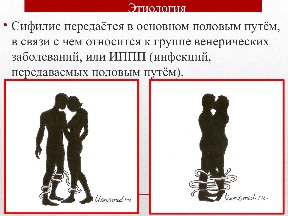 Презентация Сифилис