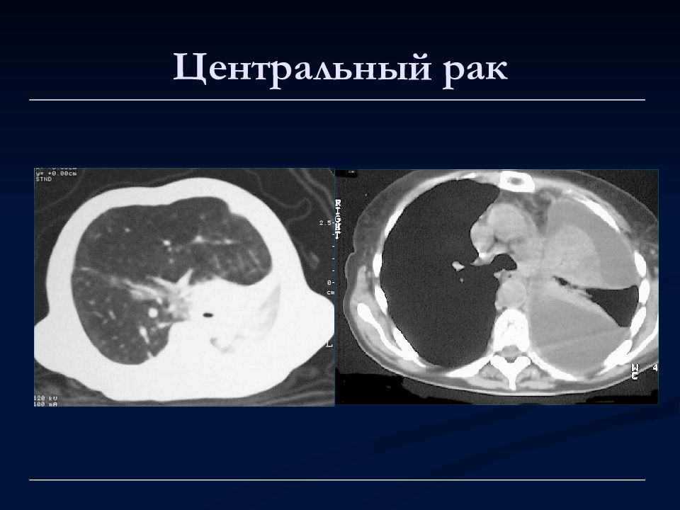 Лучевая диагностика органов дыхания презентация