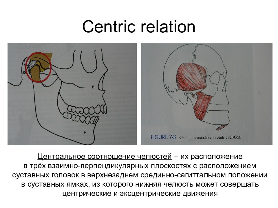 Определение центрального соотношения челюстей презентация
