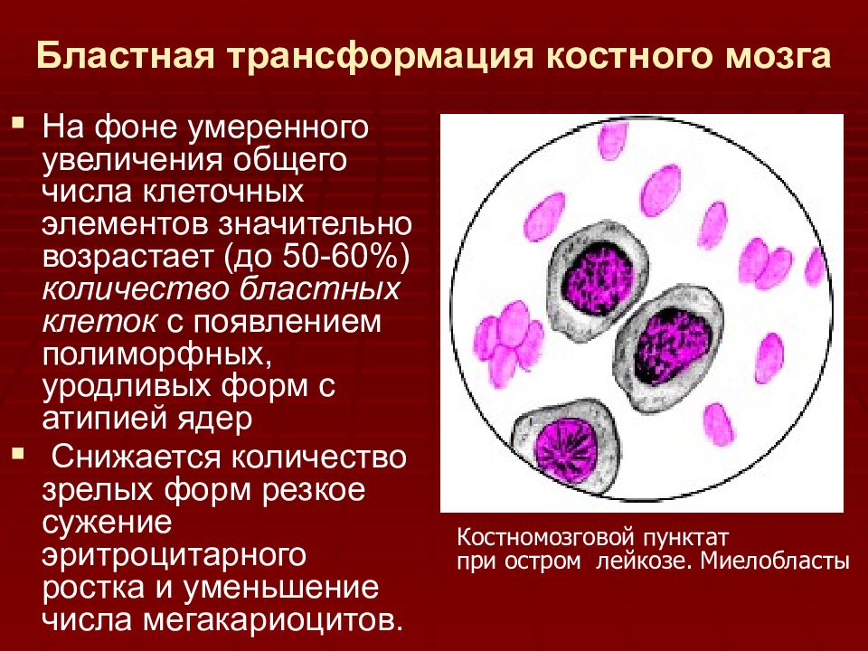 Бластные клетки. Бластные клетки при остром лейкозе. Реакция бластной трансформации лимфоцитов рисунок. Трансформация клеток костного мозга. Реакция бластной трансформации.