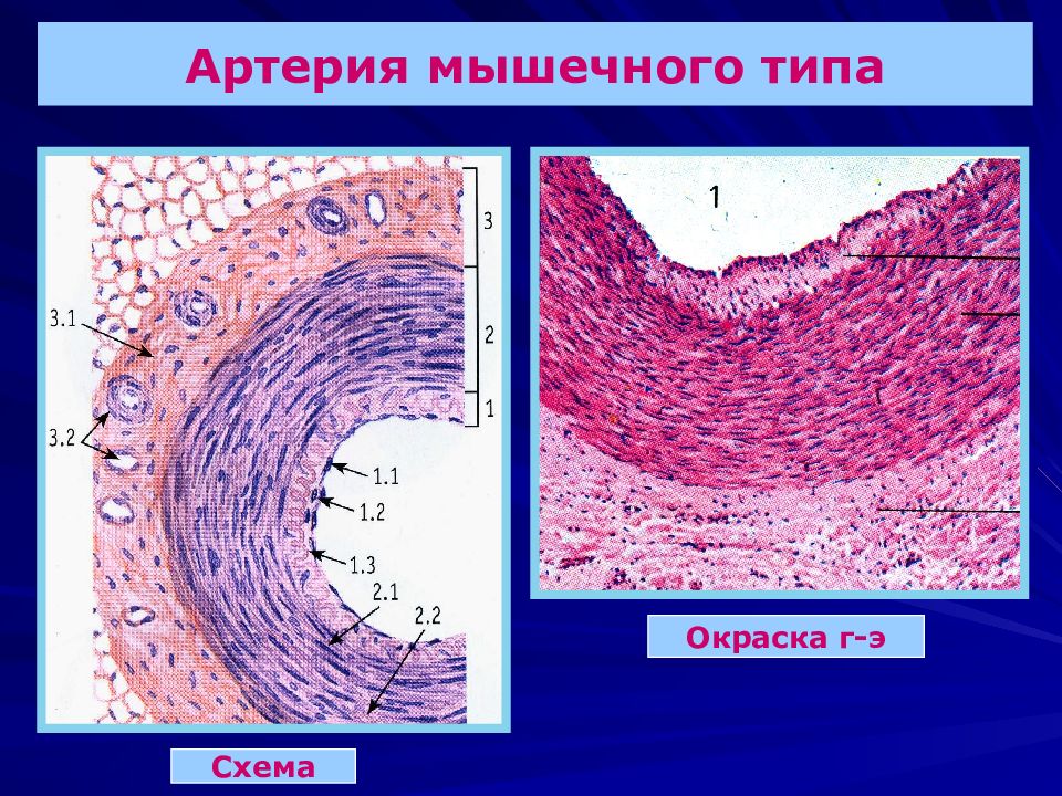 Артерии эластического типа гистология рисунок