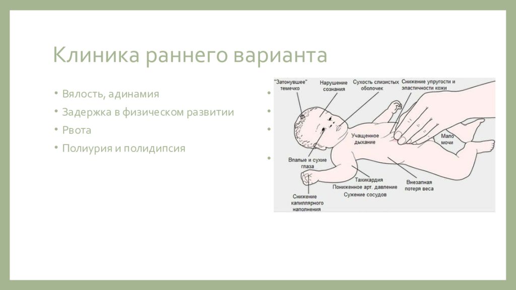 Де тони фанкони. Де то́ни — Дебре́ — Фанко́ни. Болезнь Тони-Дебре-Фанкони. Синдром де Тони Дебре Фанкони у детей. Болезнь де Тони Дебре Фанкони рентген.