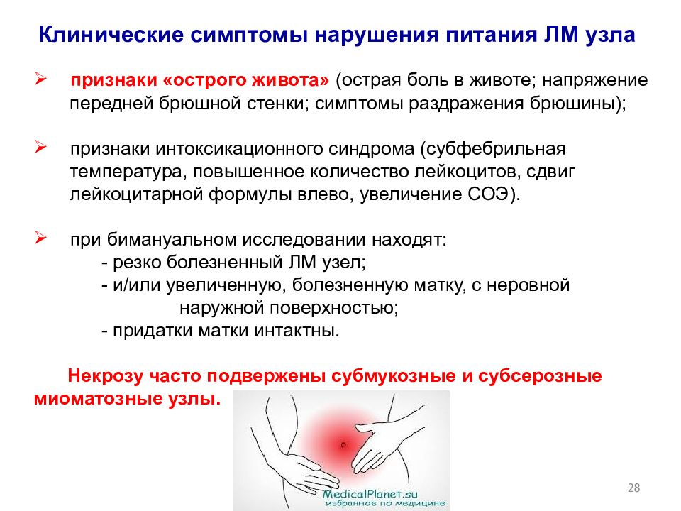 Нарушение матки. Симптомы острого живота по авторам. Симптомы раздражения брюшины по авторам при остром животе. Симптомы раздражения брюшной стенки. Синдромы раздражения брюшины по авторам.