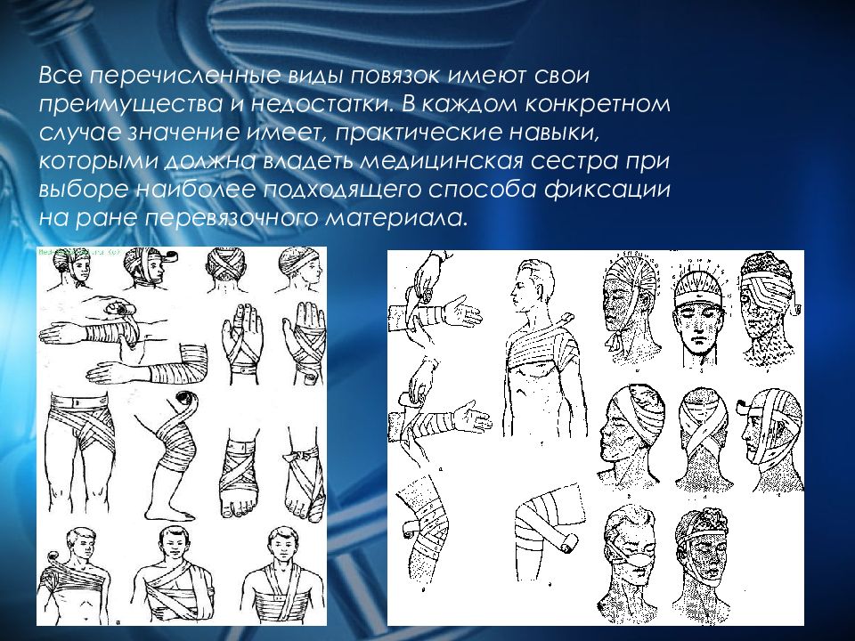 Десмургия презентация по хирургии