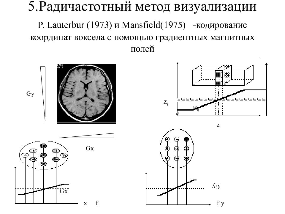 Схема мрт. Магнитное поле мрт. Градиент магнитного поля мрт. Градиентное поле в мрт это. Проекции мрт.