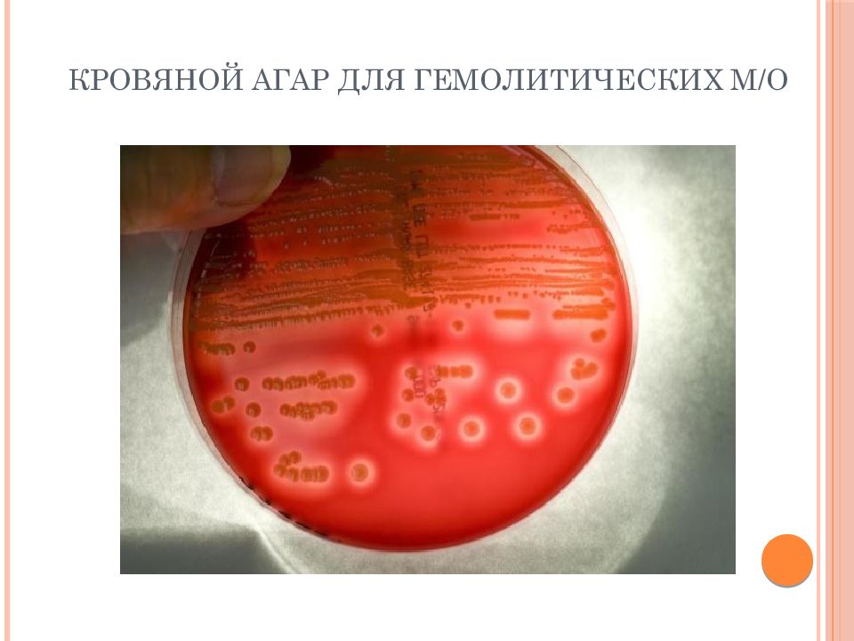 Гемолитическая кишечная палочка. Гемолитический кровяной агар. Кровяной агар с гентамицином. Гемолитическая кишечная палочка на кровяном агаре. Проявление гемолитических свойств на кровяном агаре.