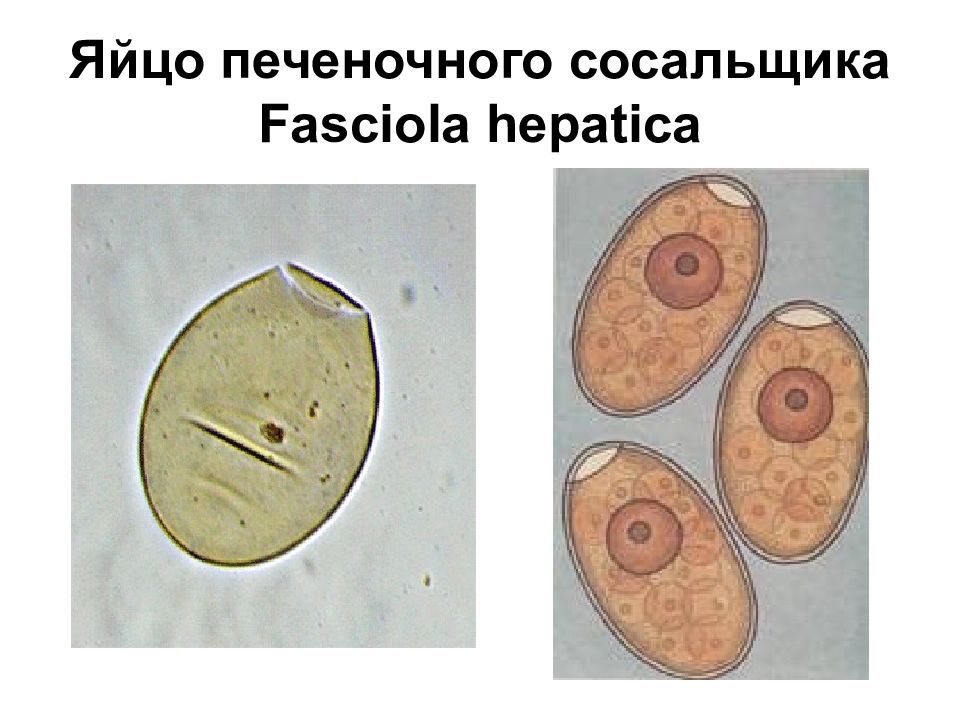 Яйца сосальщиков. Fasciola hepatica яйца. Яйцо фасциолы строение. Яйцо печеночного сосальщика препарат. Строение яйца печеночного сосальщика.