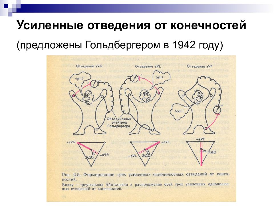 Усиленные отведения экг схема