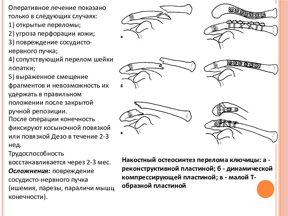 Переломы верхней конечности презентация