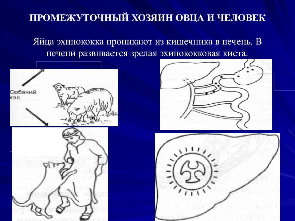 3 промежуточный хозяин. Эхинококк промежуточный хозяин. Человек промежуточный хозяин. Человек как промежуточный хозяин эхинококк.