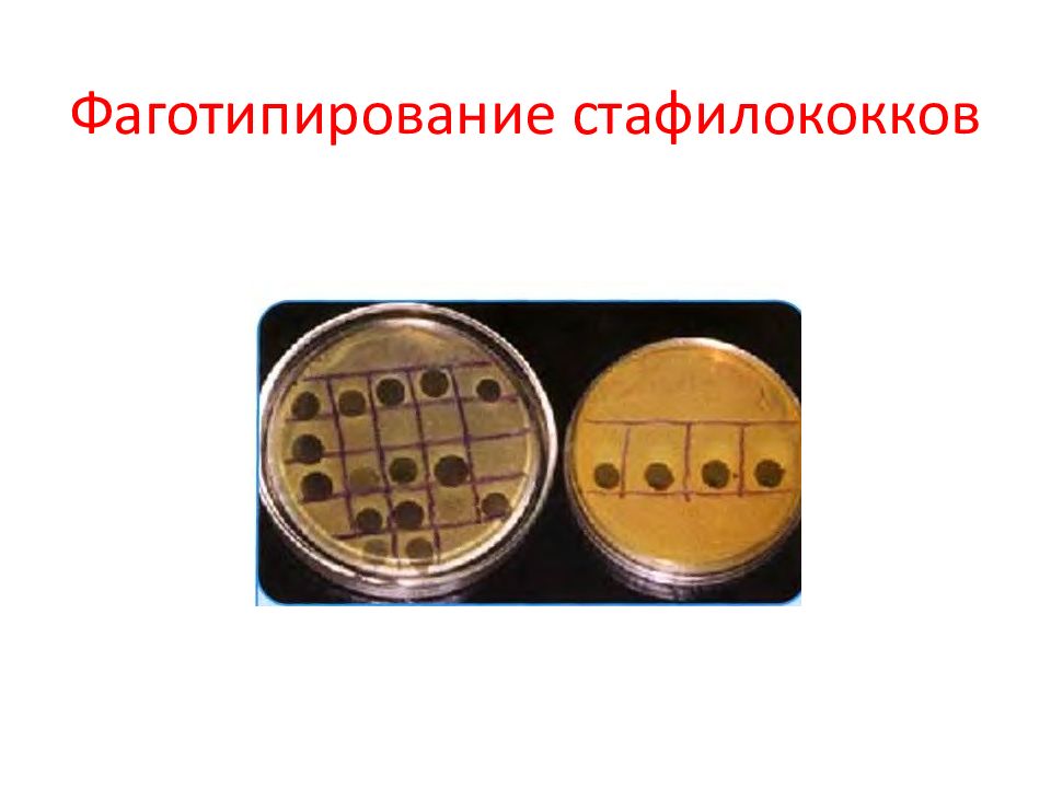 Реакция фаготипирования