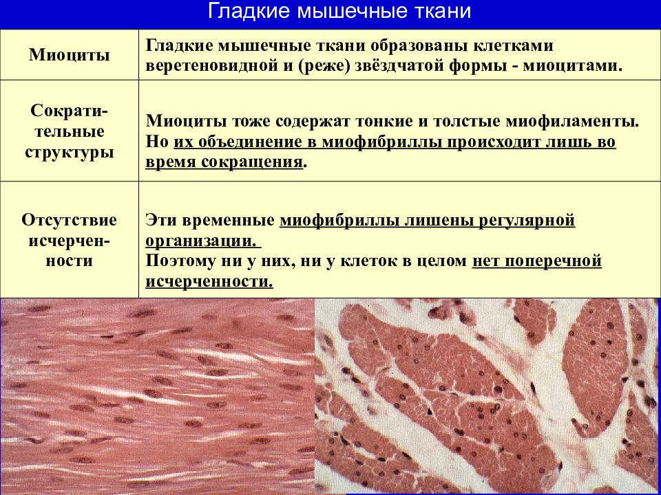 Особенности строения мышечной ткани ответ. Гладкая мышечная ткань миоцит. Гладкая мышечная ткань строение. Поперечно полосатая мышечная ткань классификация. Классификация исчерченных мышечных тканей.
