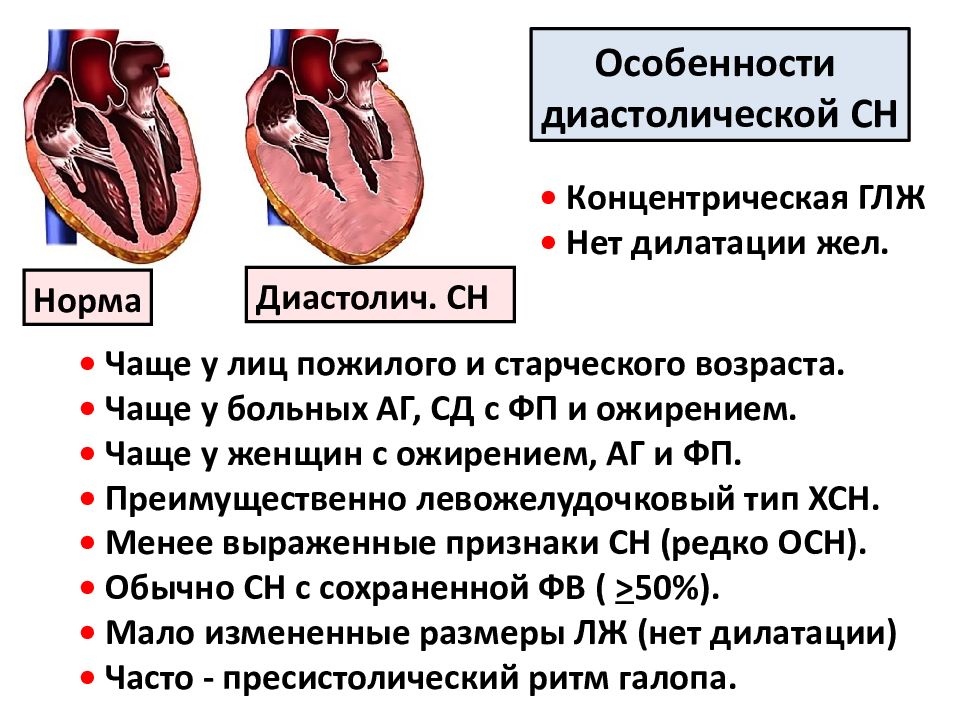 Гипертрофия левого желудочка презентация