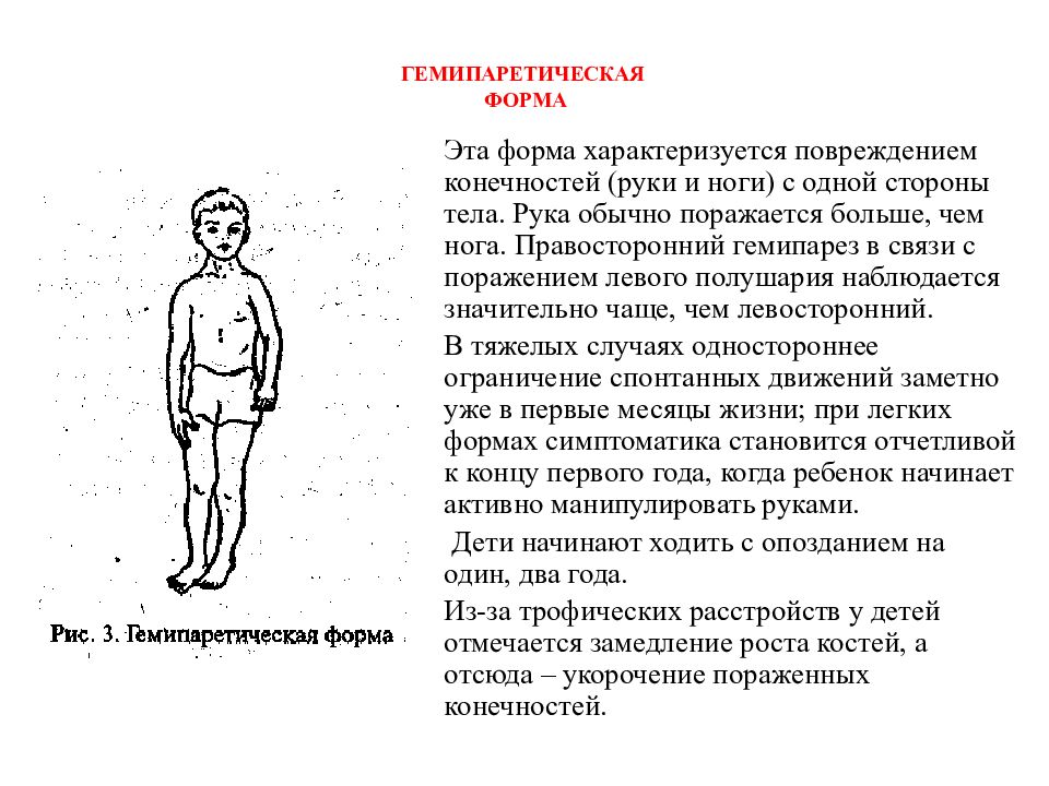 Дцп гиперкинетическая форма презентация