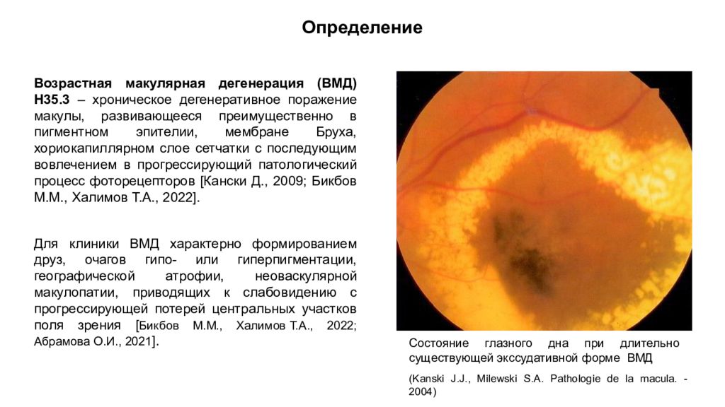 Возрастная макулярная дегенерация презентация