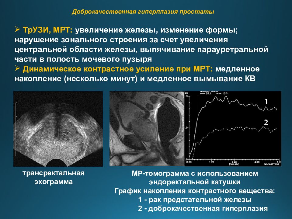 Эхографическое изображение злокачественной опухоли чаще представляет собой образование