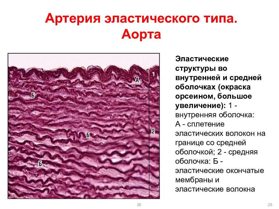 Артерия эластического типа рисунок