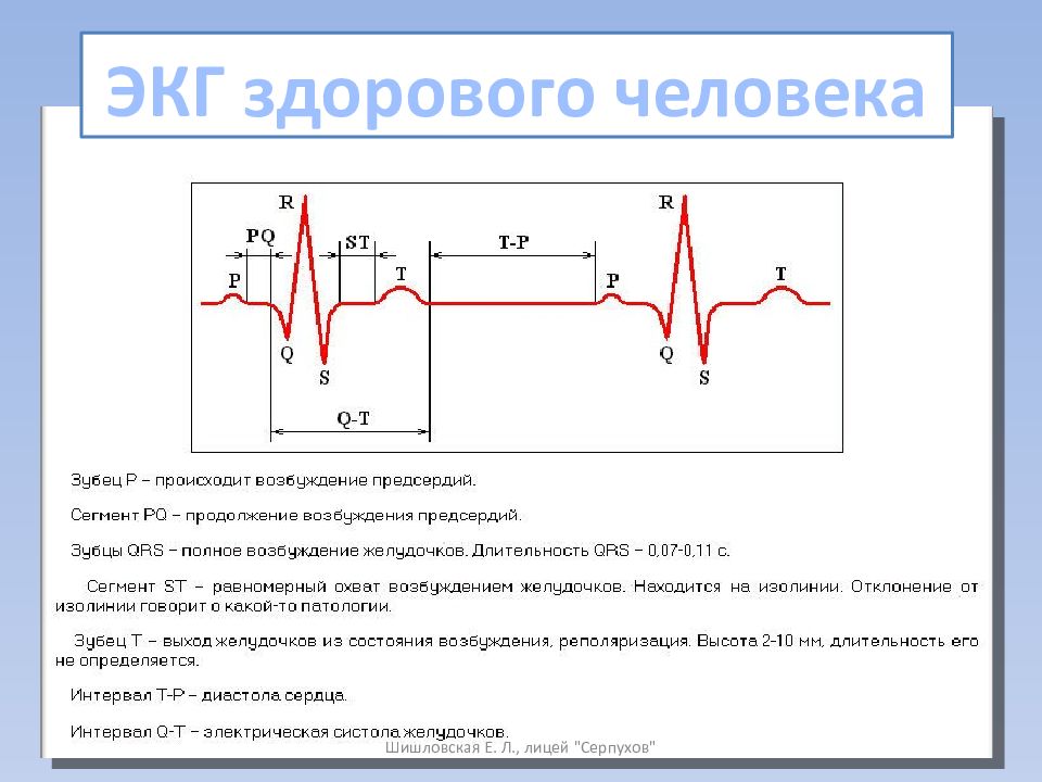 Отличие предсердий от желудочков. Электрическая систола сердца на ЭКГ это. Зубцы QRS на ЭКГ отражают. Нормальная кардиограмма здорового человека. Как выглядит ЭКГ здорового человека.