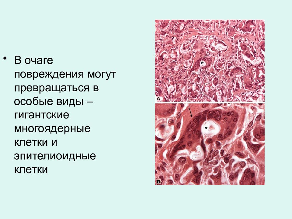 Многоядерные ткани. Эпителиоидные клетки образуются. Многоядерные клетки вид ткани. Эпителиоидные клетки образуются из:.