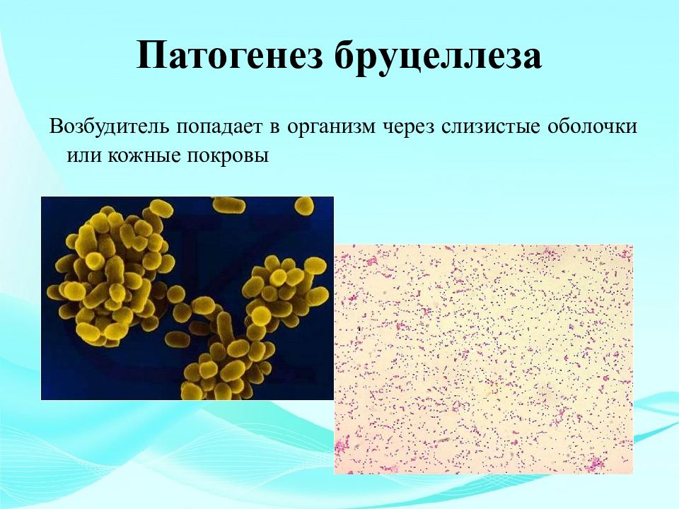 Бруцеллез презентация по микробиологии