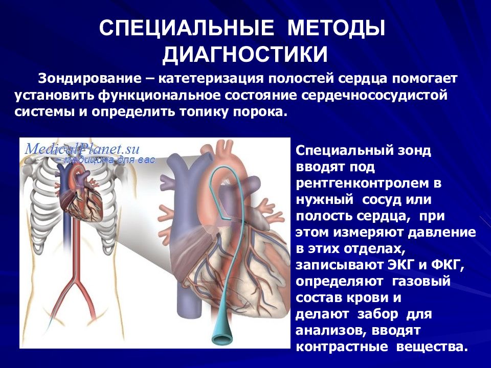 Методы сердца. Зондирование полостей сердца. Катетеризация полостей сердца. Зондирование камер сердца.