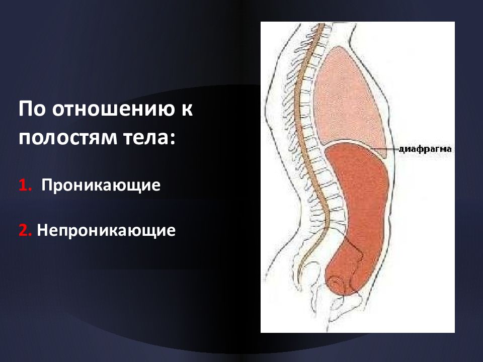 Проникающее ранение брюшной. Проникающие и непроникающие ранения. Проникающие и непроникающие раны брюшной полости. Непроникающее огнестрельное ранение. Проникающие и непроникающие травмы живота.