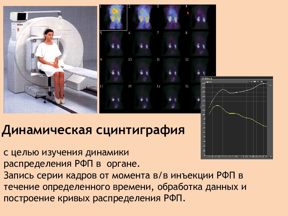 Что такое сцинтиграфия