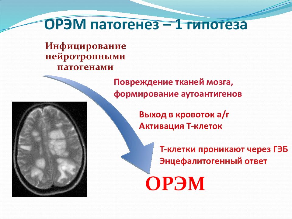 Острый рассеянный энцефаломиелит презентация