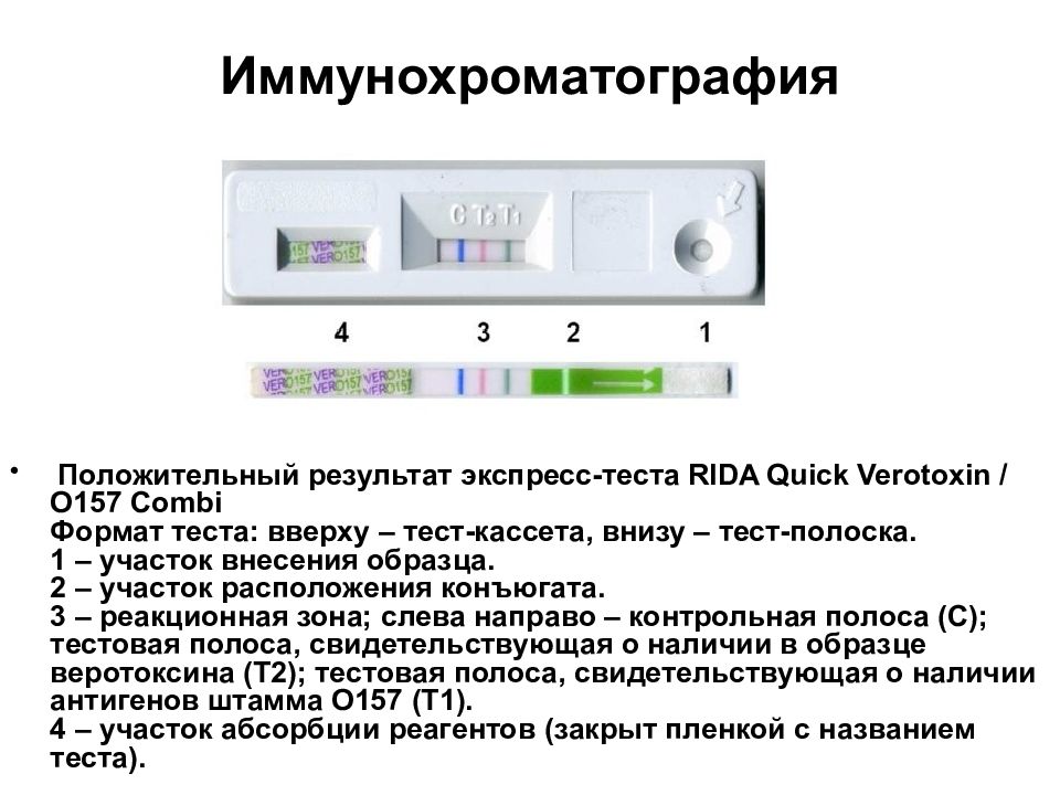 Результат экспресс теста. Результаты экспресс теста. Иммунохроматография. Как выглядит результат экспресс теста. Экспресс тесты серологические это.