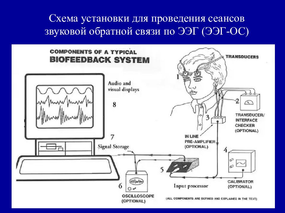 Структурная схема ээг