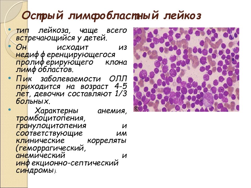 Лейкоз патофизиология презентация