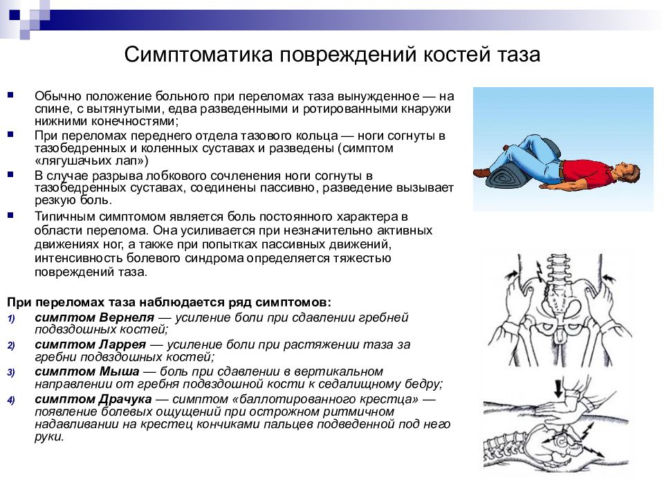 Переломы таза травматология презентация