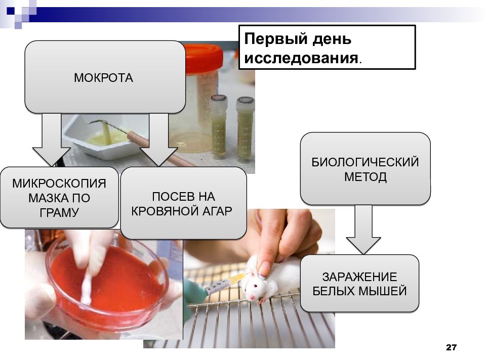 День исследования. Пневмококк методы исследования. Диагностика пневмококковой инфекции. Laboratornaya diagnostika pnevmokokovoy ingekcii. Лабораторная диагностика пневмококковой инфекции.