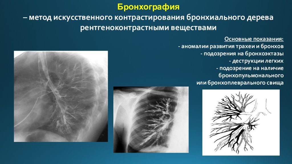 Методы лучевой диагностики органов дыхания презентация