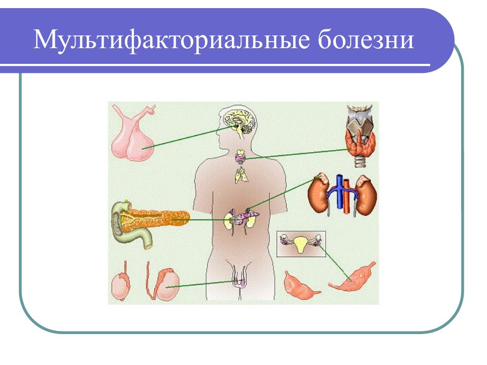 Схема харриса мультифакторные заболевания