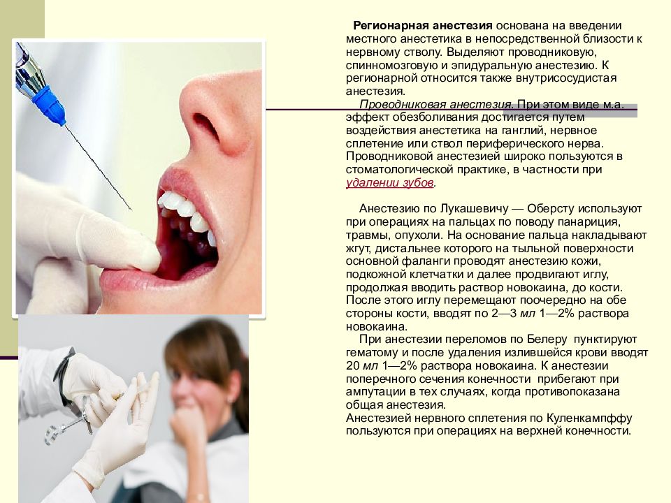 Парестезия анестезии. Местная анестезия в стоматологии.