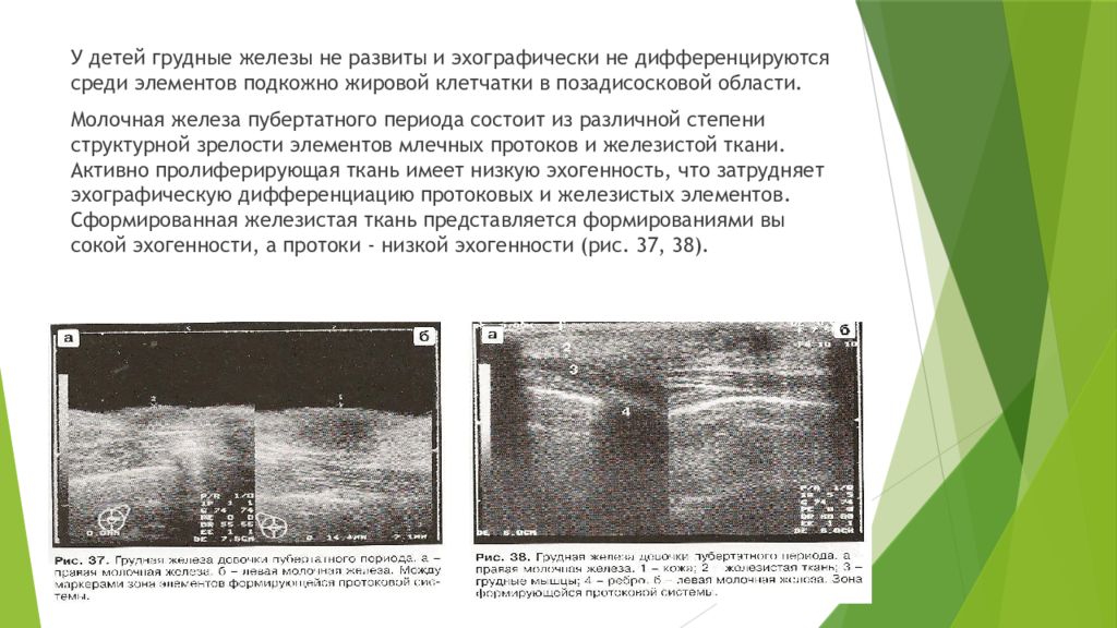 Железистый тип строения молочных желез