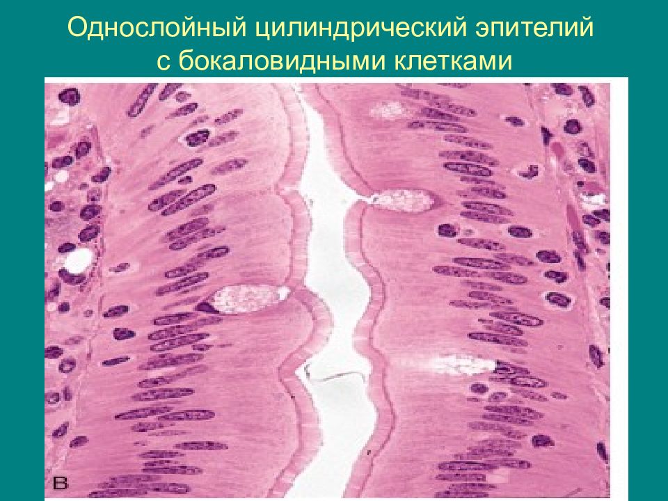 Бокаловидные клетки. Однослойный эпителий гистология. Однослойный кубический каемчатый эпителий. Однослойный цилиндрический эпителий гистология. Столбчатый цилиндрический эпителий.
