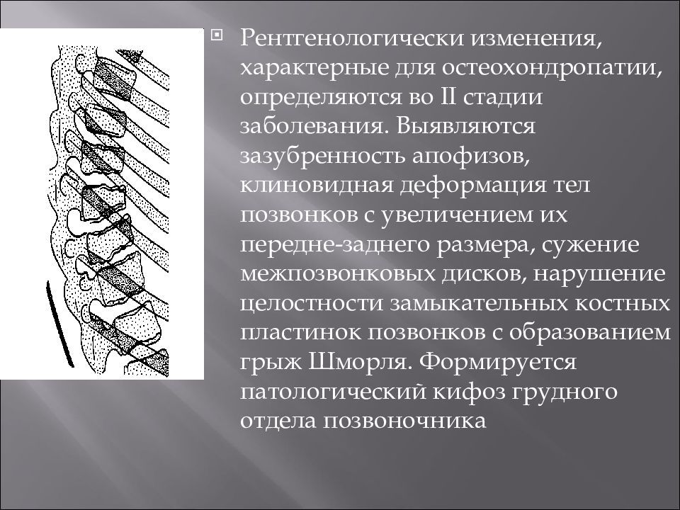 Травматология остеохондроз презентация